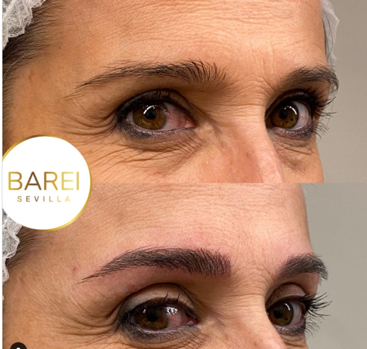 Micropigmentación y microblading: diferencias, precios y elección según piel y estética